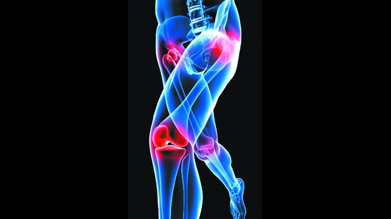Pain in Bones, Joints and Muscles - Dove Health